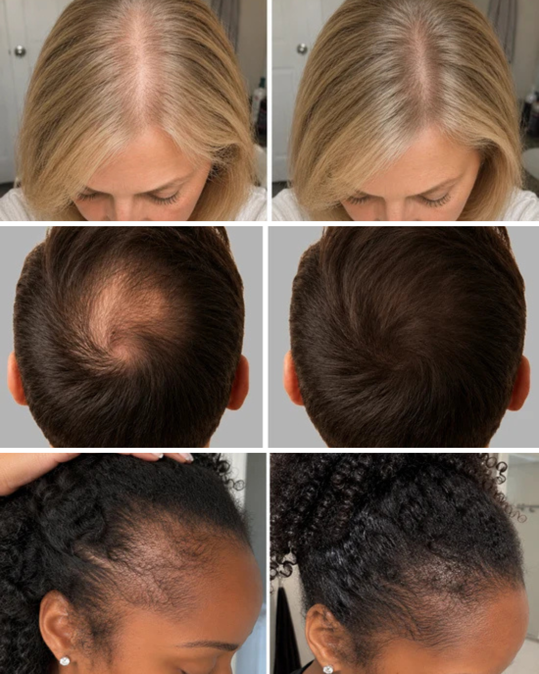 RootCalm progress and fuller-looking hair visual