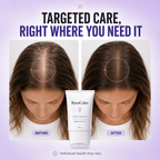 RootCalm™ Scalp Serum