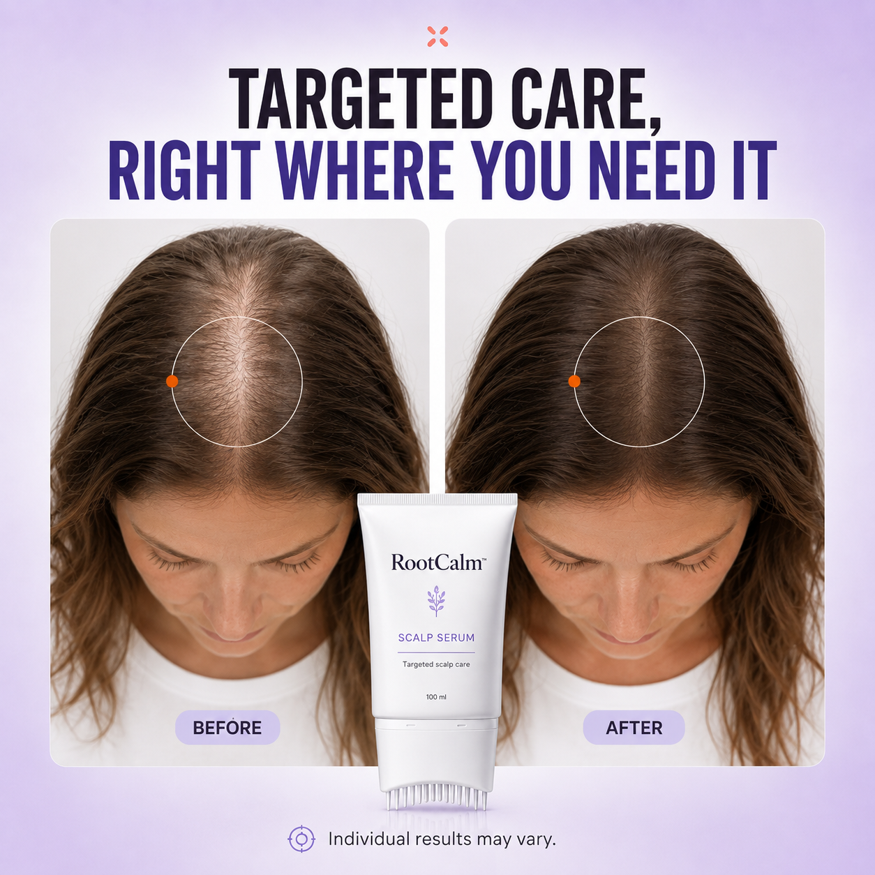 RootCalm™ Scalp Serum