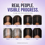 RootCalm™ Scalp Serum