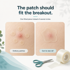 SkinSeal™ Hydrocolloid Roll