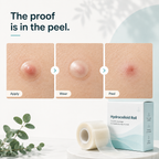 SkinSeal™ Hydrocolloid Roll