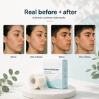 SkinSeal™ Hydrocolloid Roll